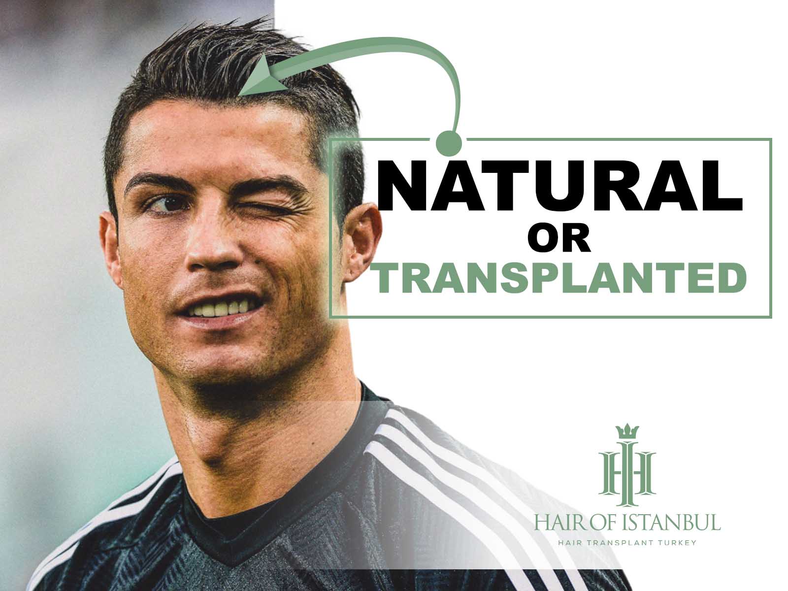 Cristiano Ronaldo Hair Transplant Natural or Transplanted?