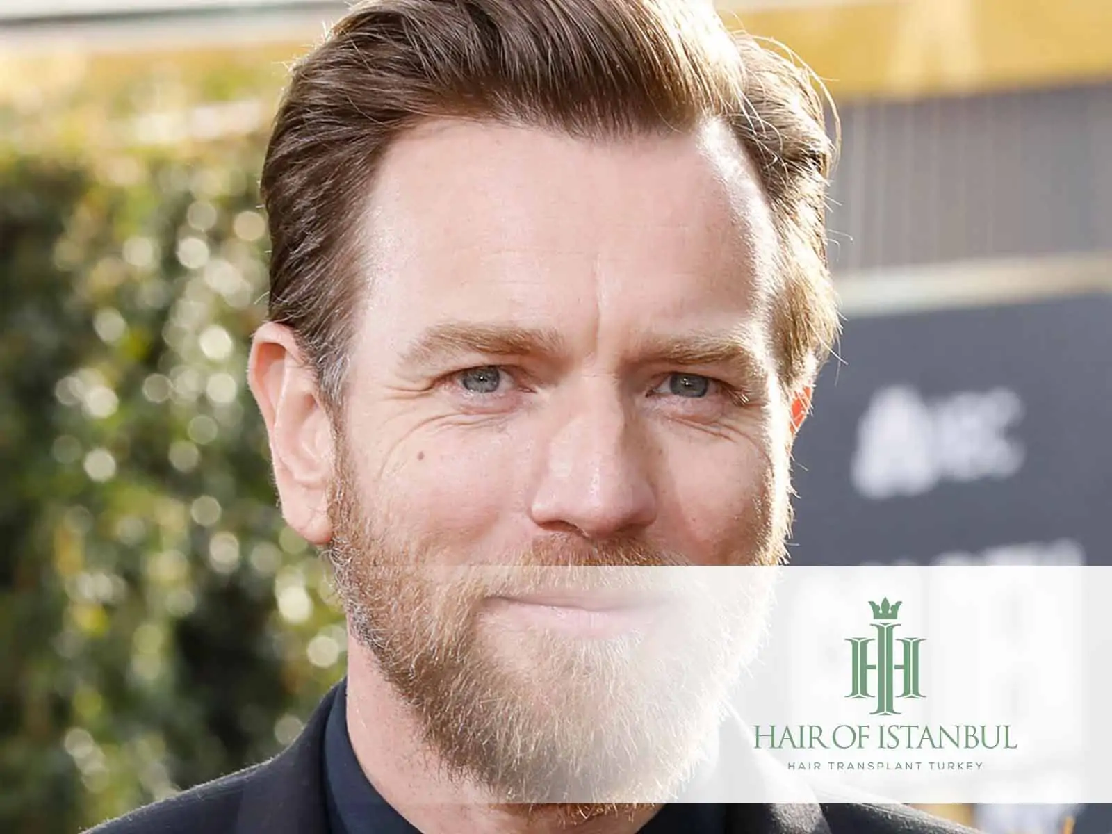 Ewan McGregor Hair Transplant: Truth or Speculation?