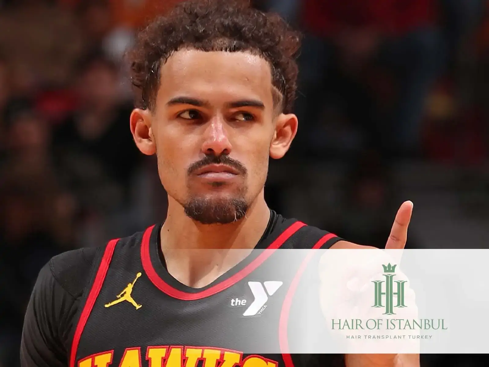 Trae Young's Hair Loss Journey: What's Happening?